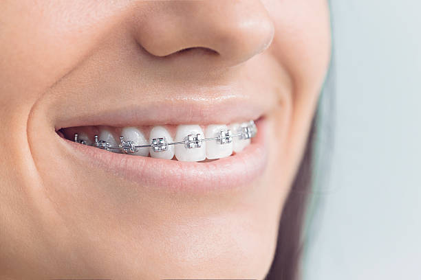 Best Full Mouth Reconstruction  in Clinton, WA
